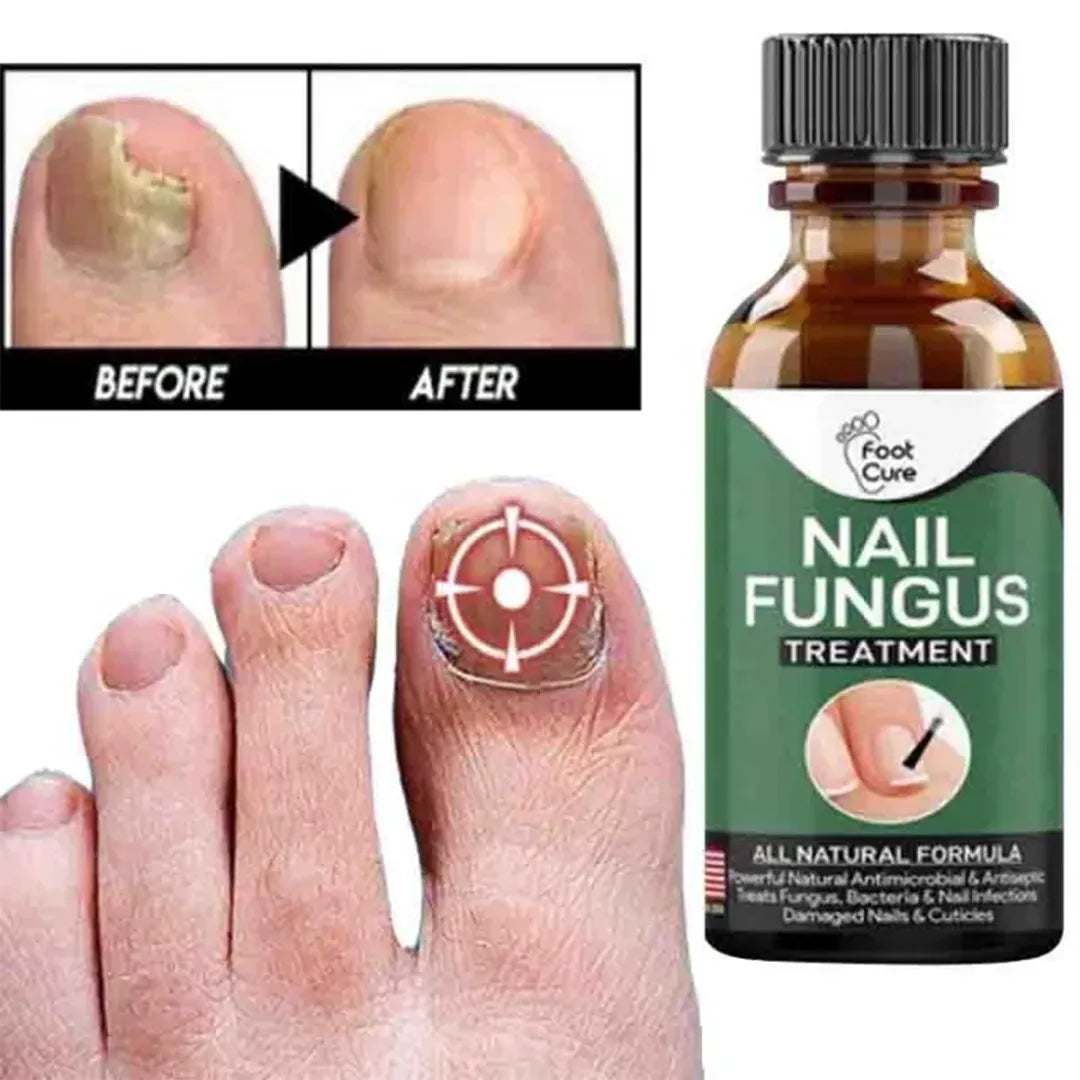 Natural ginger nail restoration serum promoting healthy new nails
