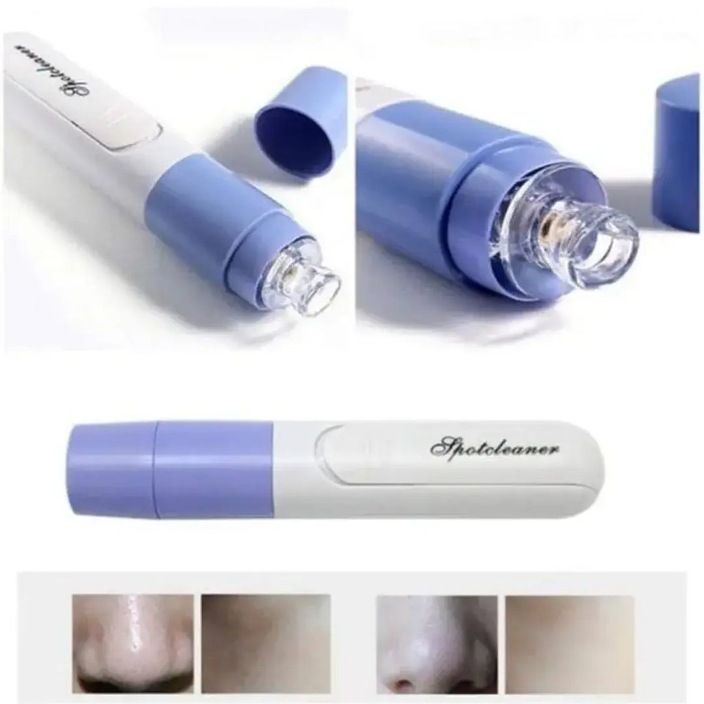 pore cleaner device for removing blackheads and oil