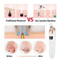electric blackhead remover vacuum pore cleaner device